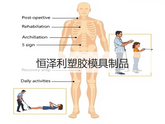 恒泽利塑胶模具制品(图2)